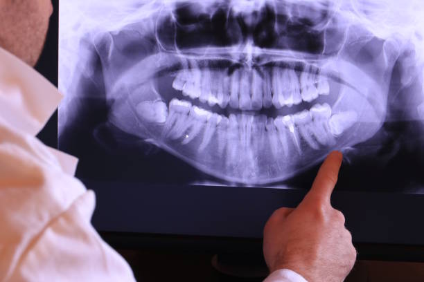 Best Emergency Treatment for Oral Infections in Federalsburg, MD
