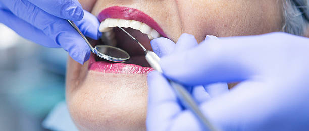 Best Broken or Chipped Tooth Repair in Federalsburg, MD